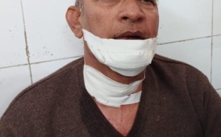 सोनभद्र पंचमुखी महादेव मंदिर के पुजारी पर जानलेवा हमला